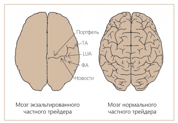 Непротрейдинг головного мозга