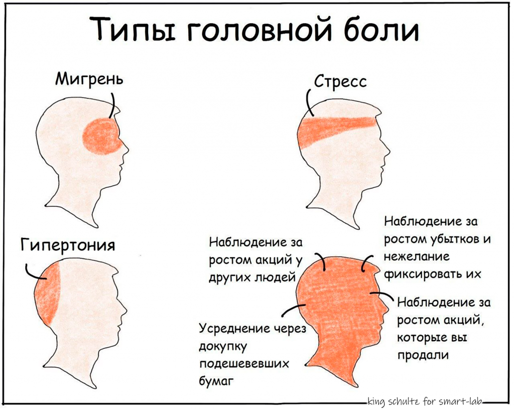 Боль в теменной области головы. Типы головной боли. Вилюды, головной боли. Локализация глазной боли. Головная боль локализация.