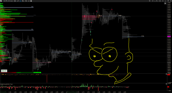 Bart Simpson's head