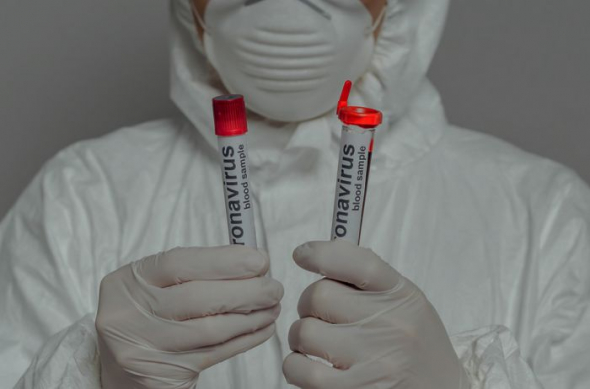 В России уже 150 тыс зараженных коронавирусом, а тем временем ученные способ как избежать смерти от этого вируса